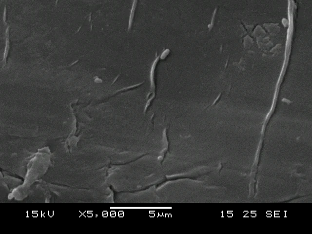 Scanning electron micrograph of the outer separating layer at 5000 times magnification
